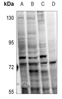 WB - Anti-PKC alpha (pT638) Antibody AP60613